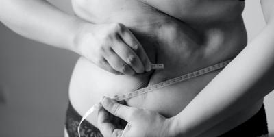 Otyłość trzeba leczyć