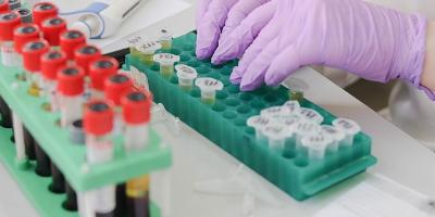 Jakie badania laboratoryjne dla kobiet są polecane?