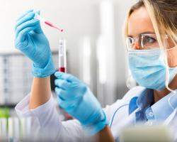 RDW-CV - czym jest i o czym świadczy podwyższone?