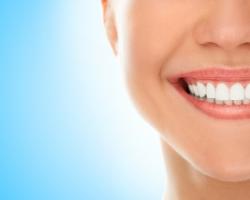 Na jaką metodę wybielania zębów się zdecydować? Sprawdzamy możliwości