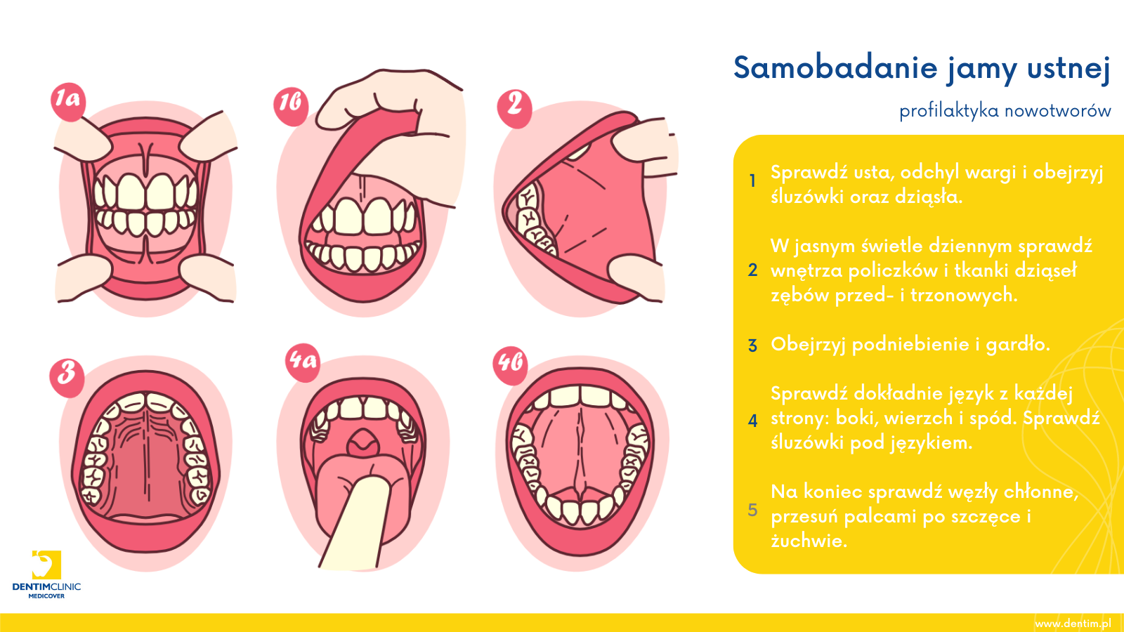 Nowotwory jamy ustnej - samobadanie w 5 krokach - RejestrMedyczny.pl